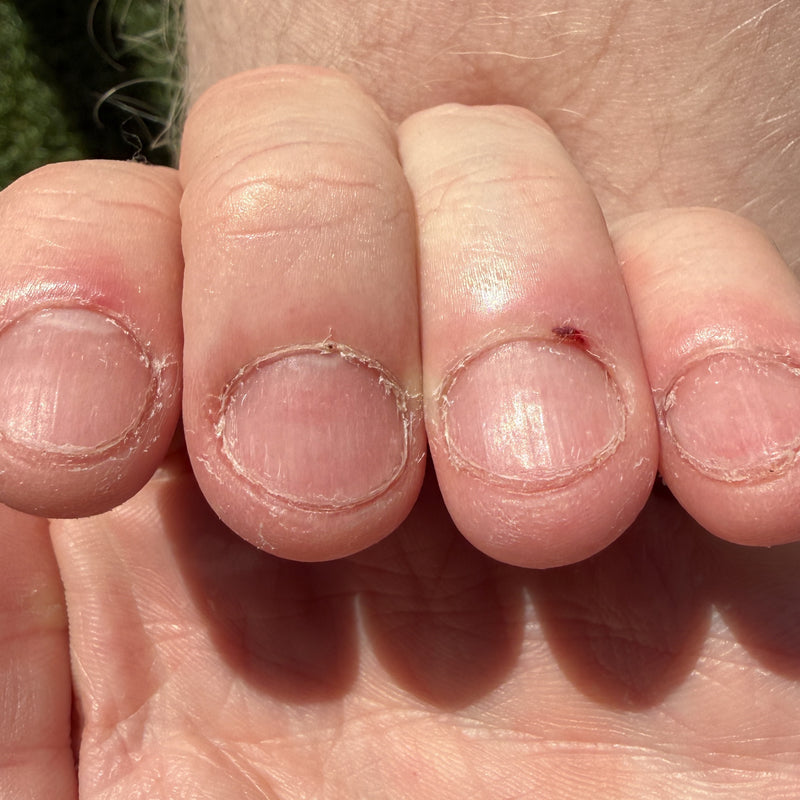 Before — Day 0