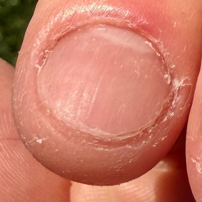 Before — Day 0