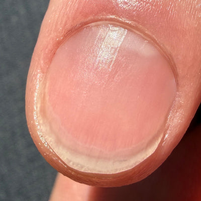 After — Day 30
