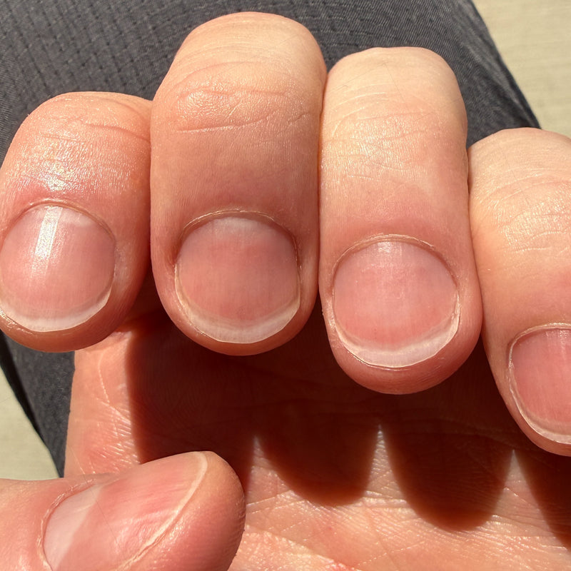 After — Day 30